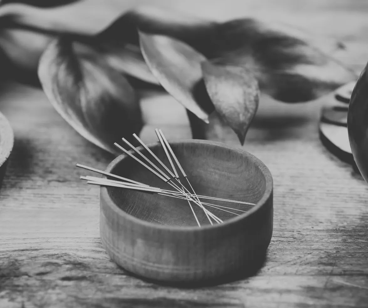 Community Acupuncture & Gong Sound Journey