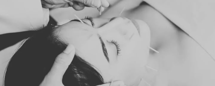 Facial Acupuncture