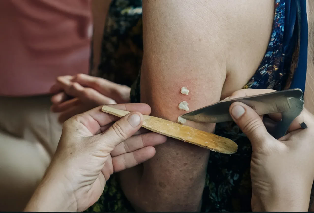 11 Days Kambo Healing Retreat in Peru – Deep Detox & Energetic Renewal