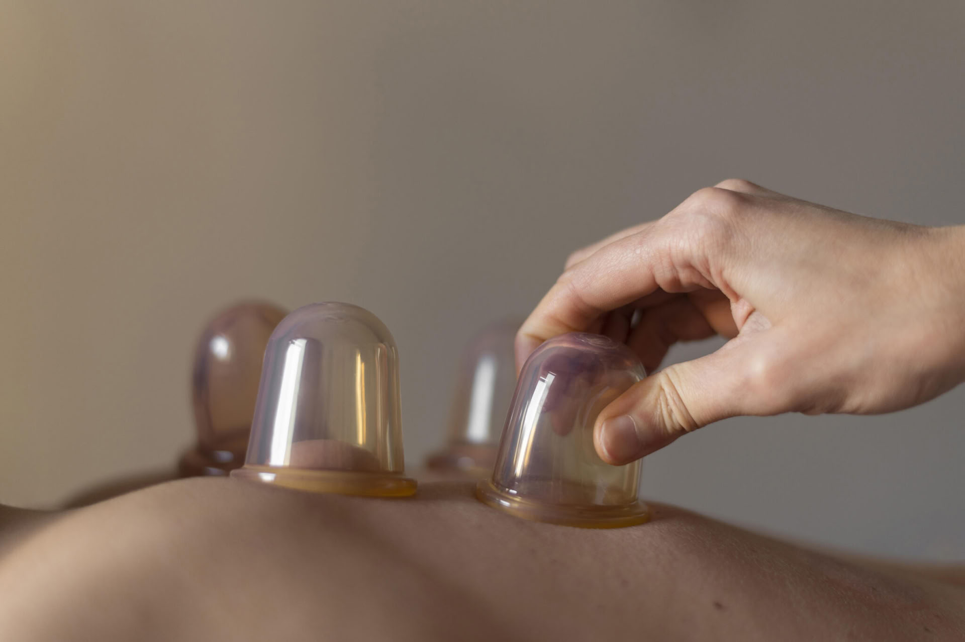 Cupping Massage
