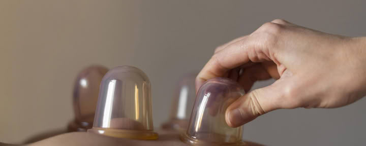 Cupping Massage