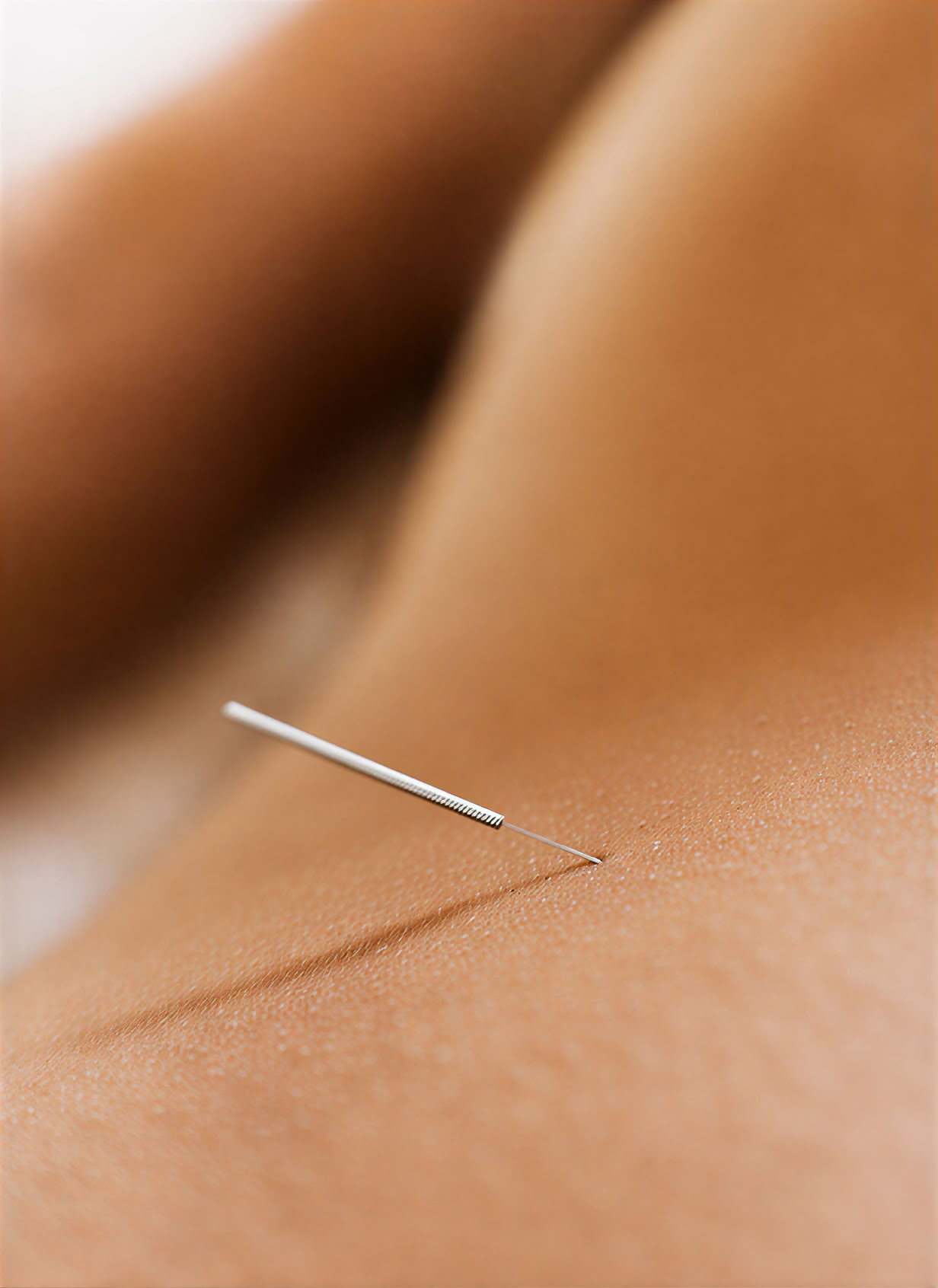 Acupuncture in Ubud