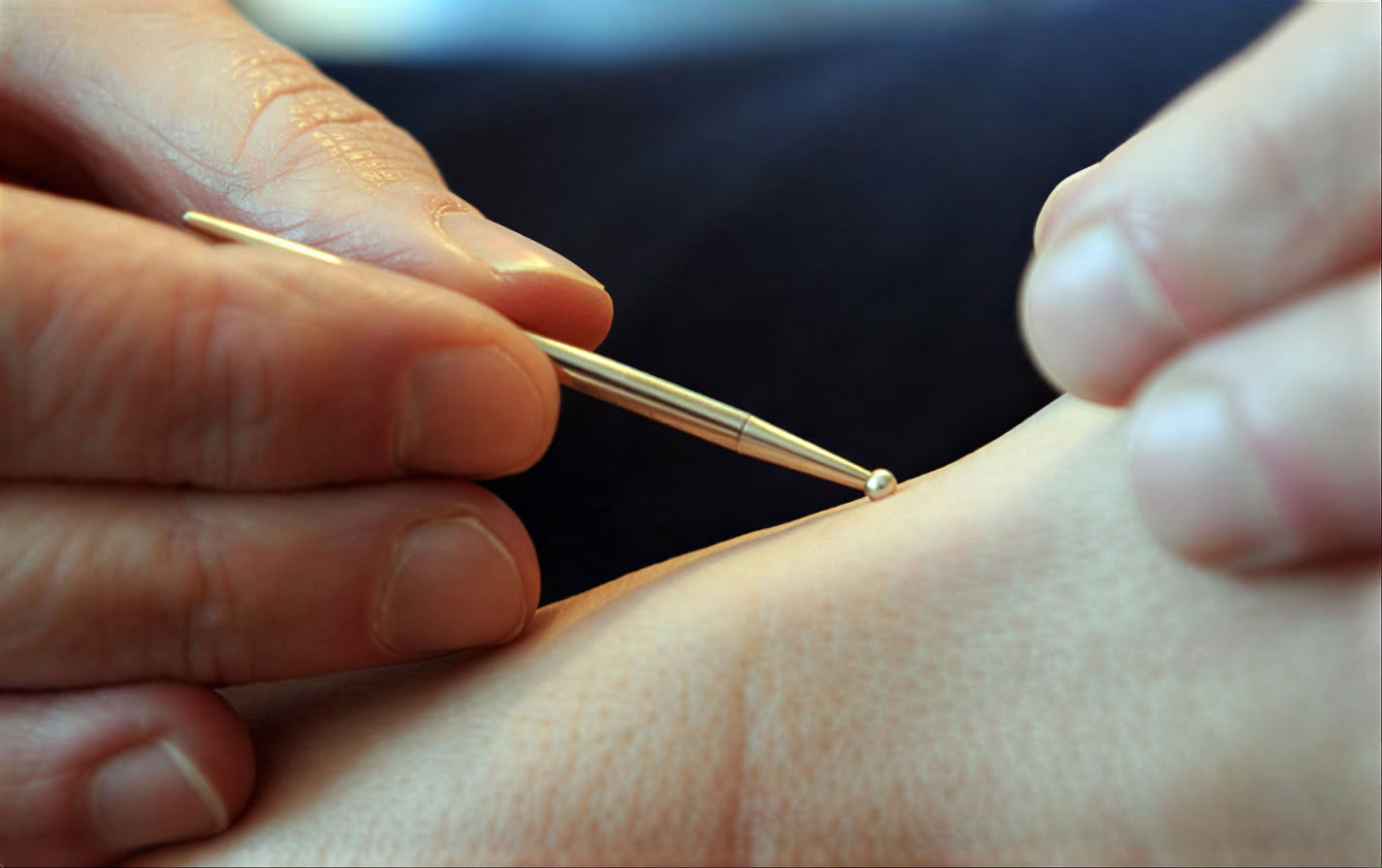 Nourishing Life LA • Acupuncture & Chinese Medicine